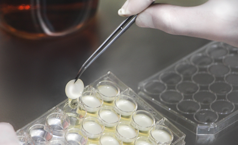 A Biocelltis Biotecnologia produz biomateriais e desenvolve tecidos humanos em laboratório.