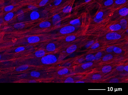 Caso de sucesso da utilização da matriz 3d cellfate da biocelltis biotecnologia